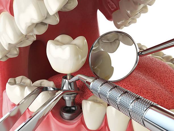 Professional Emergency Dental Service in UT